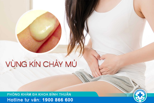 Vùng kín chảy mủ nữ giới có nguy cơ mắc bệnh gì cao?