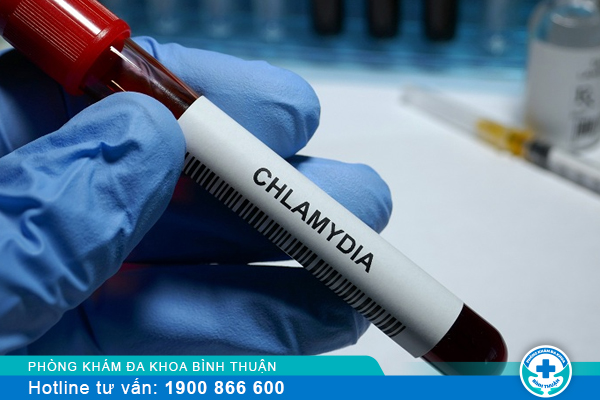 Xét nghiệm Chlamydia và địa chỉ uy tín nên thực hiện