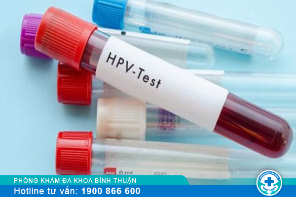 Xét nghiệm HPV ở đâu an toàn và hiệu quả hiện nay?